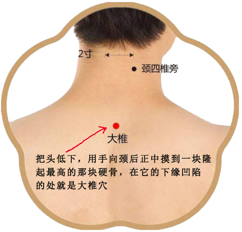 退烧绝招艾灸或按摩大椎穴退烧